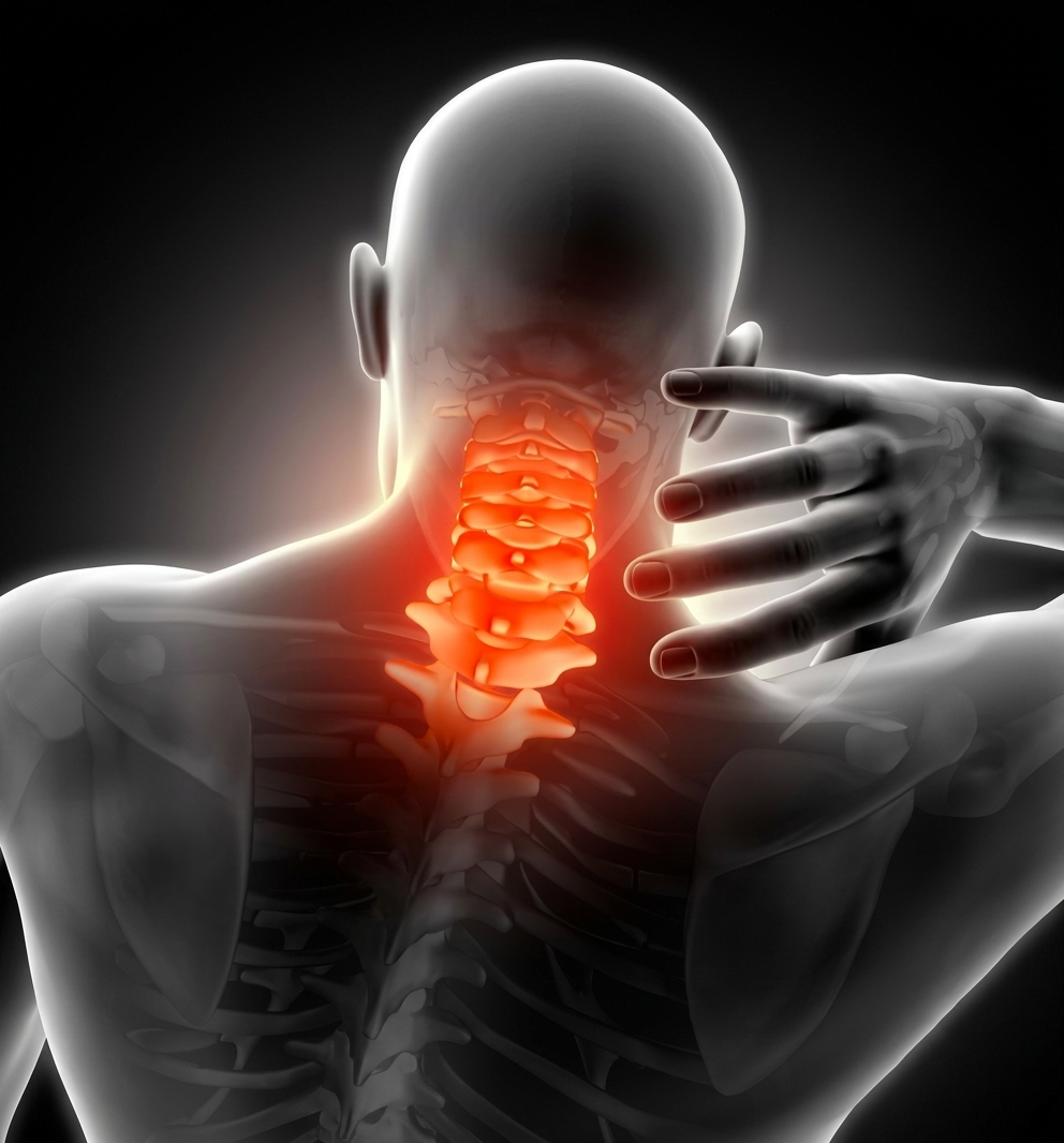 Cervical Spondylosis treatment